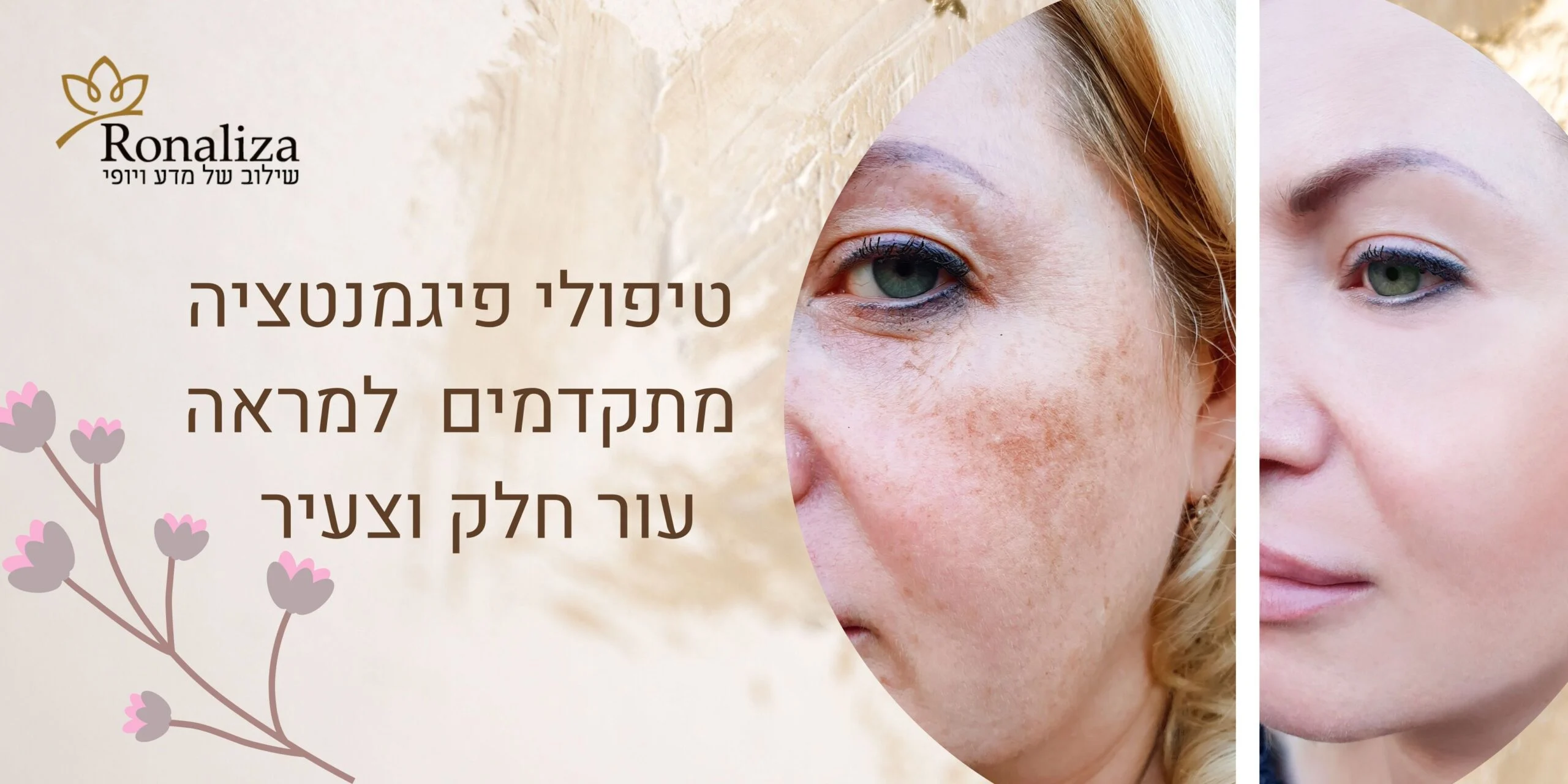 אישה עם עור מחוספס, מציגה טיפול פיגמנטציה, טקסט על טיפול בעור.